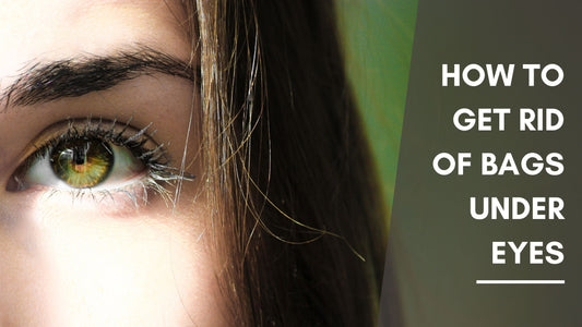 How to Get Rid of Dark Circles and Bags Under Eyes