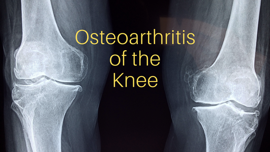 Osteoarthritis of the Knee
